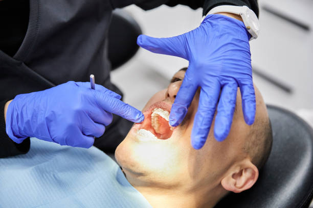 Best Emergency Wisdom Teeth Removal in Eagle Lake, TX